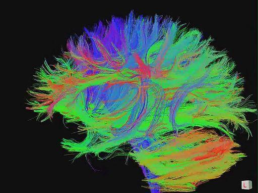 Dieci modi per mantenere giovane il cervello