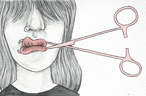 ragazza a cui viene chiusa la bocca con un bisturi