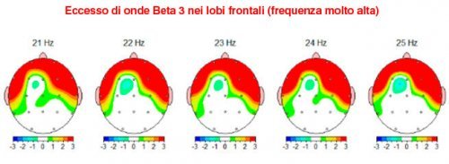 Frequenze delle onde cerebrali