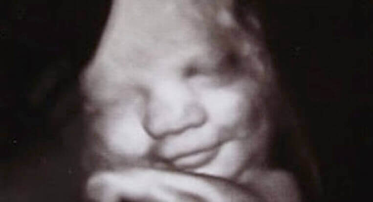Ecografia di un feto che sorride