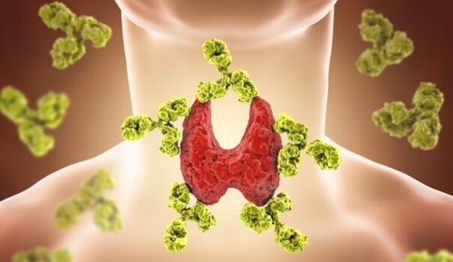 Disturbi della tiroide