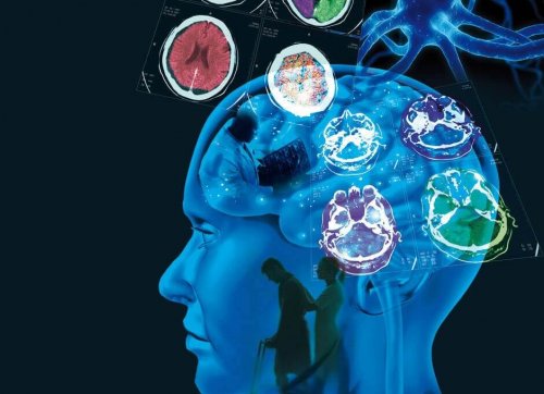 Sclerosi multipla: sintomi e trattamento