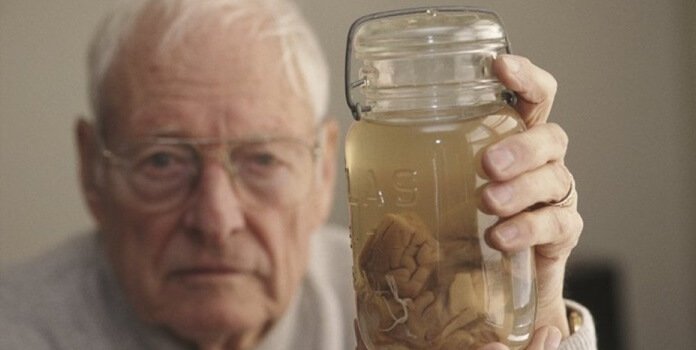 Thomas-Harvey con il cervello di Einstein