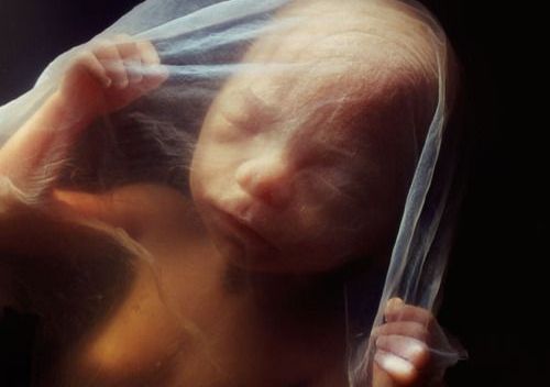 Il trauma della nascita e i suoi effetti