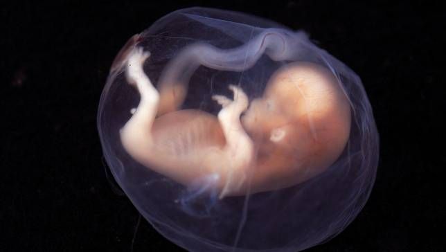 Immagine del feto su sfondo scuro