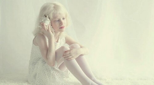 Bambina albina