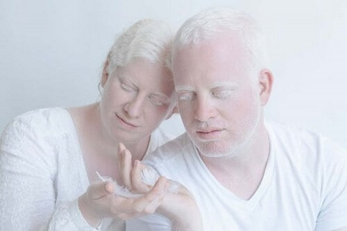 Persone albine