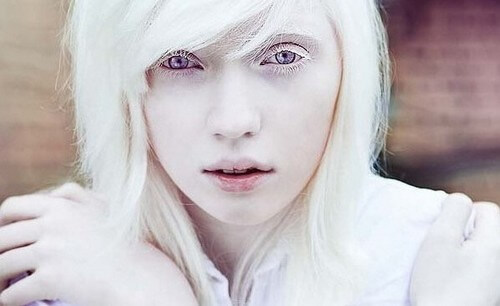 Persone albine, oltre l'aspetto fisico