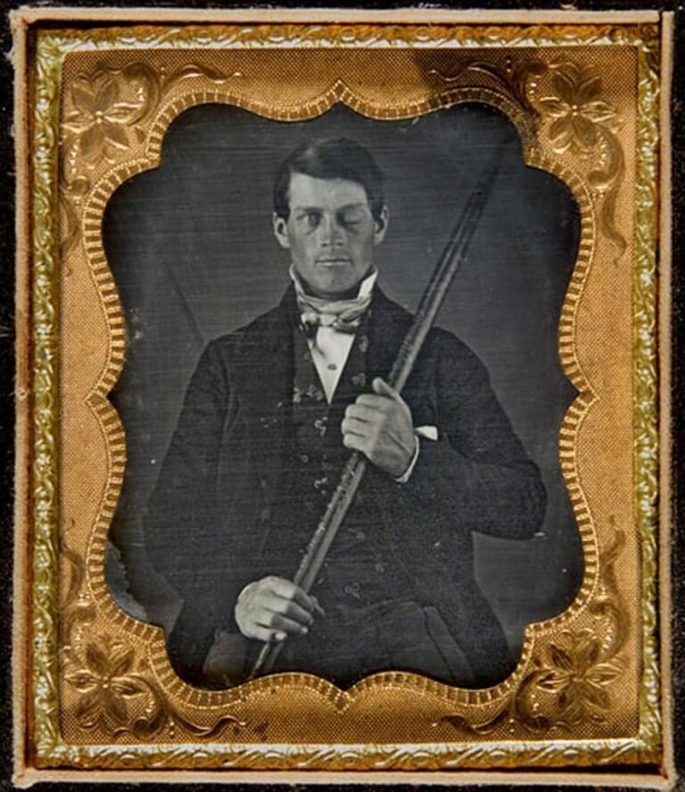 Ritratto di Phineas Gage