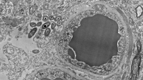 Microbioma cerebrale: batteri nel cervello