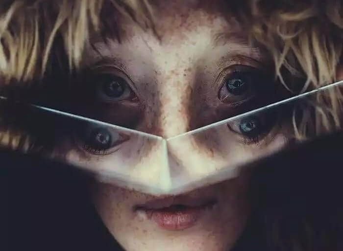 Bambino con malformazione facciale