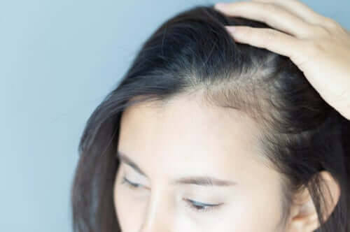 Alopecia femminile e ripercussioni psicologiche