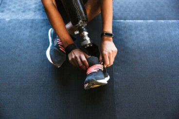 Sindrome dell'arto fantasma