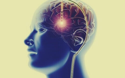 Sistema di ricompensa del cervello