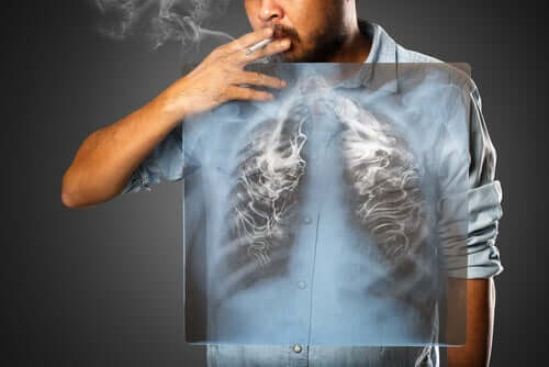 Fumatore e radiografia dei polmoni