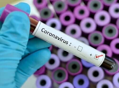 Test per coronavirus