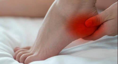 Bruciore al tallone.