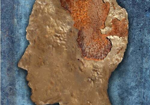 Encefalopatia spongiforme (la mucca pazza)