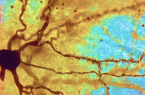 I neuroni delle persone piu intelligenti.