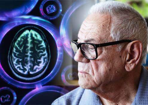 Uomo con demenza vascolare.