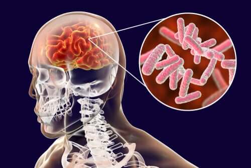 Infezioni cerebrali: classificazione e sintomi