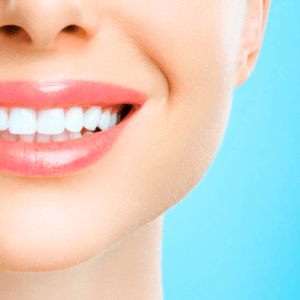 Biancoressia: ossessione per i denti bianchi
